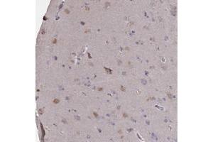 Immunohistochemical staining of human cerebral cortex with ATF7IP2 polyclonal antibody  shows moderate cytoplasmic positivity in neuronal cells at 1:200-1:500 dilution.