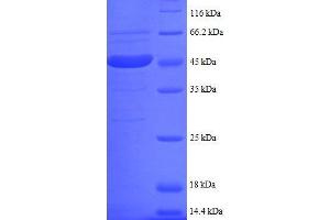 Ubiquitin-Conjugating Enzyme E2I (UBE2I) (AA 1-157), (partial) protein (GST tag)
