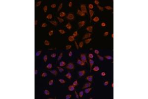Immunofluorescence analysis of L929 cells using NDUF antibody (ABIN7268806) at dilution of 1:100. (NDUFAF2 antibody  (AA 1-169))