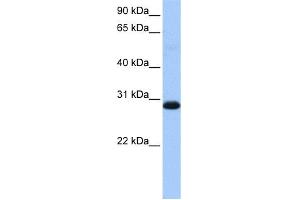 WB Suggested Anti-WARS2 Antibody Titration: 0. (WARS2 antibody  (Middle Region))