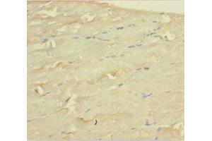 Immunohistochemistry of paraffin-embedded human skeletal muscle tissue using ABIN7159662 at dilution of 1:100 (WDR77 antibody  (AA 1-312))