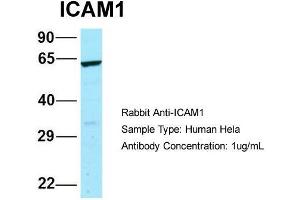 Western Blotting (WB) image for anti-Intercellular Adhesion Molecule 1 (ICAM1) (N-Term) antibody (ABIN2787947)