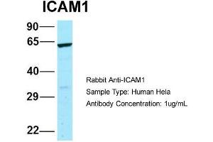 Host: Rabbit  Target Name: ICAM1  Sample Tissue: Human Hela  Antibody Dilution: 1. (ICAM1 antibody  (N-Term))