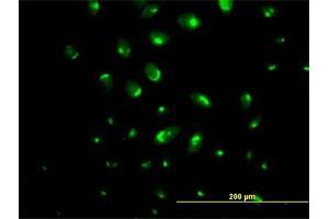 Immunofluorescence of purified MaxPab antibody to ATP2C1 on HeLa cell. (ATP2C1 antibody  (AA 1-919))