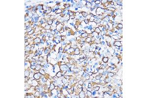 Immunohistochemistry (IHC) image for anti-Keratin 5 (KRT5) antibody (ABIN3016405)