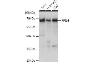Western blot analysis of extracts of various cell lines, using PPIL4 antibody (ABIN7269212) at 1:1000 dilution.
