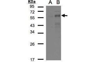 WB Image Western Blot analysis of EGR2 expression in transfected 293T cell line by EGR2 polyclonal antibody.