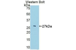 Detection of Recombinant IL22Ra2, Rat using Polyclonal Antibody to Interleukin 22 Receptor Alpha 2 (IL22Ra2) (IL22RA2 antibody  (AA 30-228))