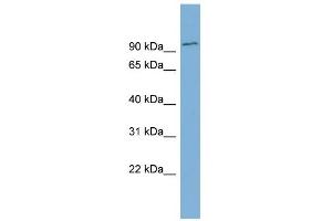 WB Suggested Anti-FBXO34 Antibody Titration: 0. (FBXO34 antibody  (Middle Region))