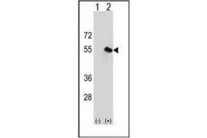 Western blot analysis of CPN1 (arrow) using CPN1 Antibody (Center) Cat. (CPN1 antibody  (Middle Region))