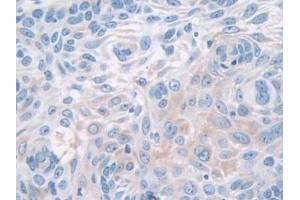 Immunohistochemistry (IHC) image for anti-phosphorylase, Glycogen, Brain (GPBB) (AA 477-731) antibody (ABIN7439942)
