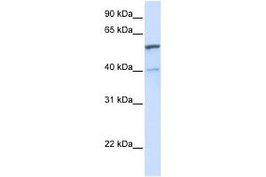 UGT1A6 antibody used at 1 ug/ml to detect target protein. (UGT1A6 antibody  (C-Term))