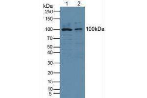 Detection of Recombinant cPLA2, Human using Polyclonal Antibody to Cytosolic Phospholipase A2 (PLA2G4) (PLA2G4A antibody  (AA 563-749))