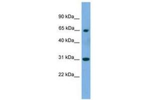 Image no. 1 for anti-Polynucleotide Kinase 3'-Phosphatase (PNKP) (AA 359-408) antibody (ABIN6744968) (PNKP antibody  (AA 359-408))