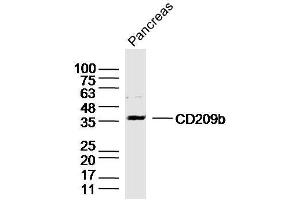 Pancreas lysates probed with DC-SIGNR1/CD209b Polyclonal Antibody, Unconjugated  at 1:300 dilution and 4˚C overnight incubation.