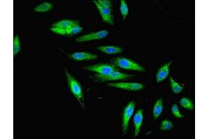 Immunofluorescent analysis of Hela cells using ABIN7176063 at dilution of 1:100 and Alexa Fluor 488-congugated AffiniPure Goat Anti-Rabbit IgG(H+L) (ZFYVE16 antibody  (AA 1-280))