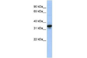 WB Suggested Anti-MUC3B Antibody Titration: 0.