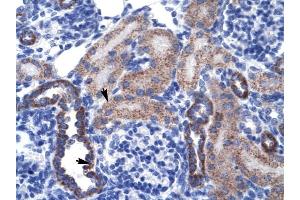 RGS13 antibody was used for immunohistochemistry at a concentration of 4-8 ug/ml to stain Epithelial cells of renal tubule (arrows) in Human Kidney. (RGS13 antibody  (Middle Region))