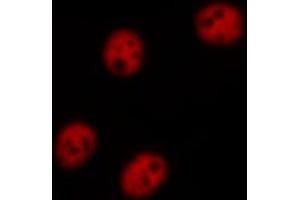 ABIN6267656 staining HeLa cells treated with TNF-a 20nM 15' by ICC/IF. (NFKBIB antibody  (pSer23))
