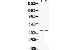 Western Blotting (WB) image for anti-Mitogen-Activated Protein Kinase Kinase 3 (MAP2K3) (AA 311-347), (C-Term) antibody (ABIN3043874) (MAP2K3 antibody  (C-Term))