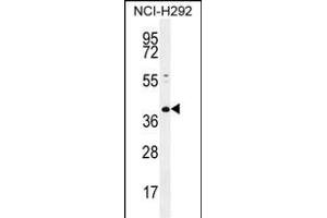 KCTD2 Antibody (C-term) (ABIN655466 and ABIN2844993) western blot analysis in NCI- cell line lysates (35 μg/lane). (KCTD2 antibody  (C-Term))