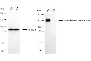 Western blotting analysis using neurofilament medium chain antibody (ABIN7800956).