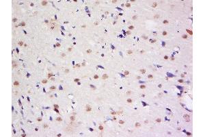 Formalin-fixed and paraffin embedded rat brain labeled with Anti-Dymeclin Polyclonal Antibody, Unconjugated  at 1:200 followed by conjugation to the secondary antibody and DAB staining. (Dymeclin antibody  (AA 151-250))