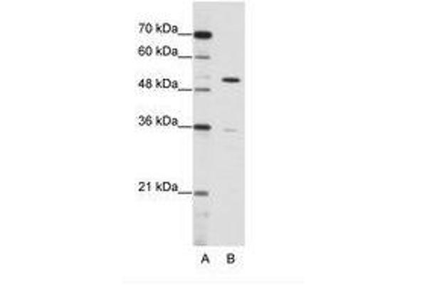 ZNF485 antibody  (C-Term)