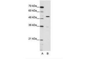 ZNF485 antibody  (C-Term)