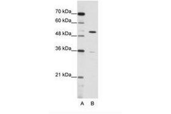 ZNF485 Antikörper  (C-Term)
