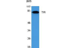 Western Blot (WB) analysis of specific cells using TYR Polyclonal Antibody. (TYR antibody  (C-Term))