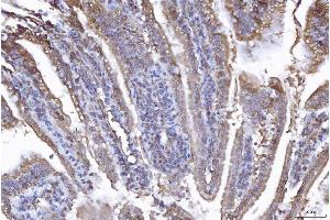 IHC analysis of EIF5A using anti-EIF5A antibody (ABIN7602568). (EIF5A antibody  (AA 86-154))