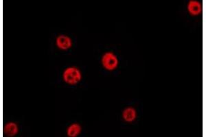 ABIN6267642 staining Hela by IF/ICC. (HDAC1 antibody  (pSer421))