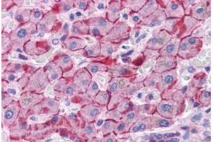 Human Liver: Formalin-Fixed, Paraffin-Embedded (FFPE) (E-cadherin antibody  (AA 503-552))