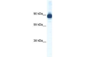 WB Suggested Anti-ACTN2 Antibody Titration:  0. (ACTN2 antibody  (C-Term))