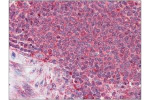 Formalin-Fixed, Paraffin-Embedded Human Spleen stained with Thrombospondin-1 antibody at 3. (Thrombospondin 1 antibody  (N-Term))