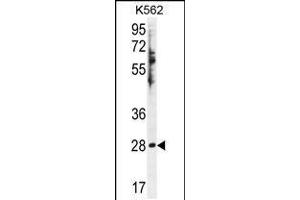 Western blot analysis in K562 cell line lysates (35ug/lane). (HSD11B1L antibody  (C-Term))