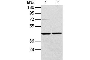 Western Blot analysis of Hepg2 and hela cell using RRAGA Polyclonal Antibody at dilution of 1:400