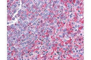 Immunohistochemistry (IHC) image for anti-SRY (Sex Determining Region Y)-Box 2 (SOX2) (N-Term) antibody (ABIN2777428) (SOX2 antibody  (N-Term))