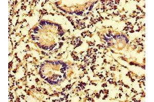 Immunohistochemistry of paraffin-embedded human appendix tissue using ABIN7157942 at dilution of 1:100