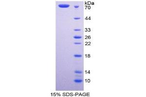 SDS-PAGE (SDS) image for Fibulin 4 (FBLN4) (AA 26-443) protein (His tag,GST tag) (ABIN2122866)