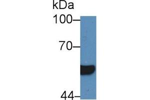 Western blot analysis of Human Serum, using Human HNF1b Antibody (5 µg/ml) and HRP-conjugated Goat Anti-Rabbit antibody ( (HNF1B antibody  (AA 159-300))