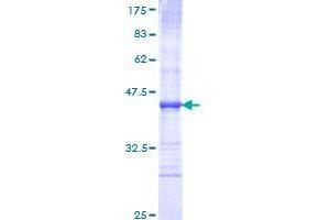 SEMA6A Protein (AA 21-120) (GST tag)