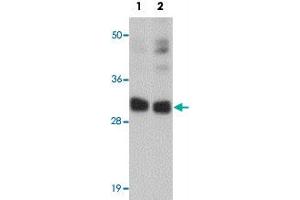 Western blot analysis of CCDC106 in human brain tissue lysate with CCDC106 polyclonal antibody  at (1) 0. (CCDC106 antibody  (C-Term))