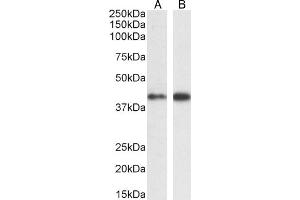 Western Blotting (WB) image for anti-Mitogen-Activated Protein Kinase 3 (MAPK3) (N-Term) antibody (ABIN185399)