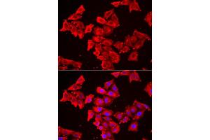 Immunofluorescence analysis of HeLa cell using SMPX antibody.