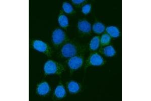 IF analysis of PMPCB using anti-PMPCB antibody (ABIN7600757).