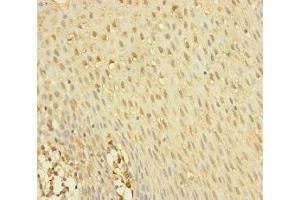 Immunohistochemistry of paraffin-embedded human tonsil tissue using ABIN7145012 at dilution of 1:100 (YME1L1 antibody  (AA 1-240))