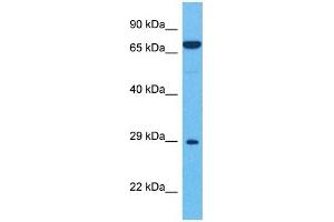 Host:  Rabbit  Target Name:  HDAC1  Sample Tissue:  Human 293T Whole Cell  Antibody Dilution:  1ug/ml (HDAC1 antibody  (C-Term))