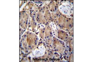 LIMD1 Antibody (C-term) (ABIN657056 and ABIN2846223) immunohistochemistry analysis in formalin fixed and paraffin embedded human stomach tissue followed by peroxidase conjugation of the secondary antibody and DAB staining. (LIMD1 antibody  (C-Term))